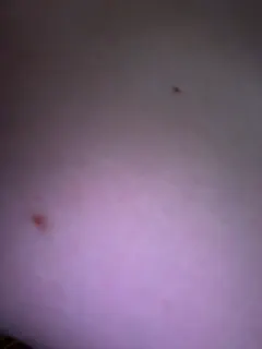 marsandvenera