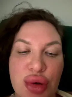 mollekiss