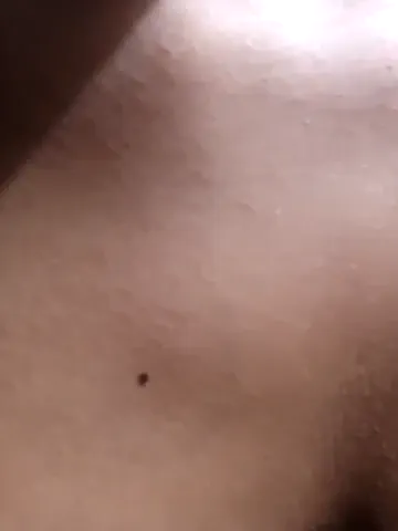 bald_gee