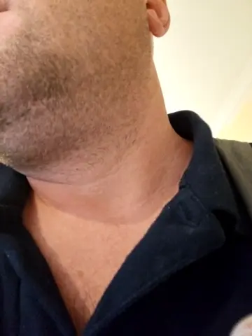 seloloko20